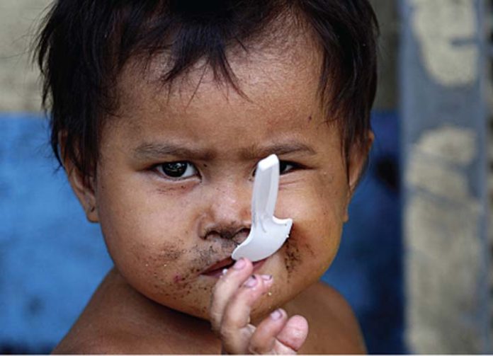 In Photo: In this September 6, 2010, file photo, three-year-old homeless child Minerva Botongan bites a plastic spoon as she takes a meal given to her and her family by good Samaritans on a street in Manila.